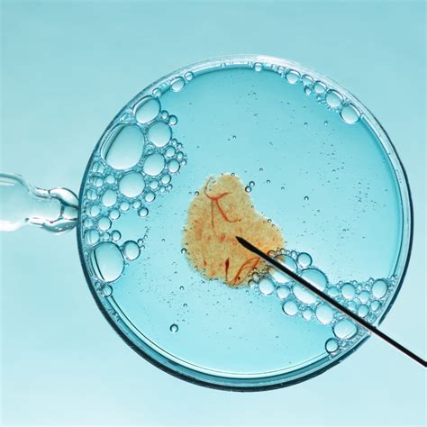 Ivf Atau Fertilisasi In Vitro Tiara Ivf