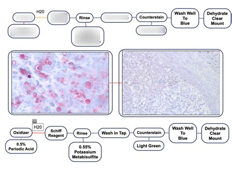 PAS Fungal Stain Diagram | Quizlet