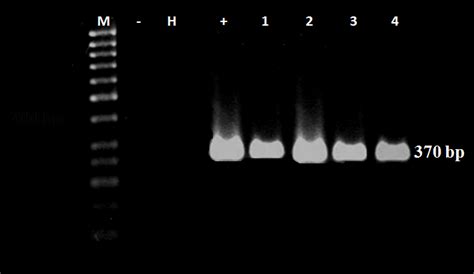 Detection Of Citrus Exocortis Viroid CEVd In 4 Citrus Trees Using