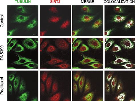 Figure W5 Confocal Microscopy Analysis Showing That The Colocalization Download Scientific