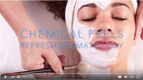 Chemical Peel Refresh Dermatology