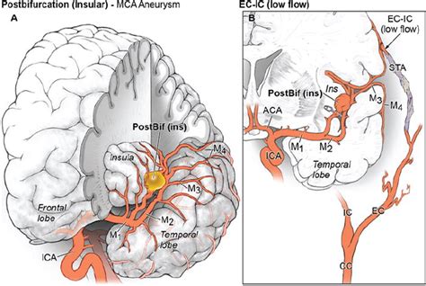 Mca Anatomy Anatomical Charts And Posters