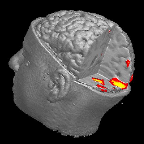 Fmri Functional Magnetic Resonance Imaging Lab