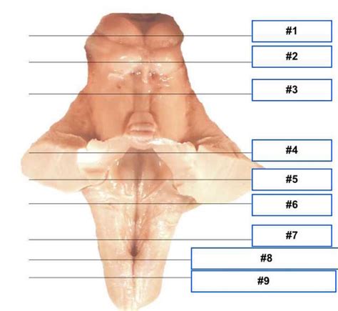 Neuro Lab Pictures Flashcards Quizlet