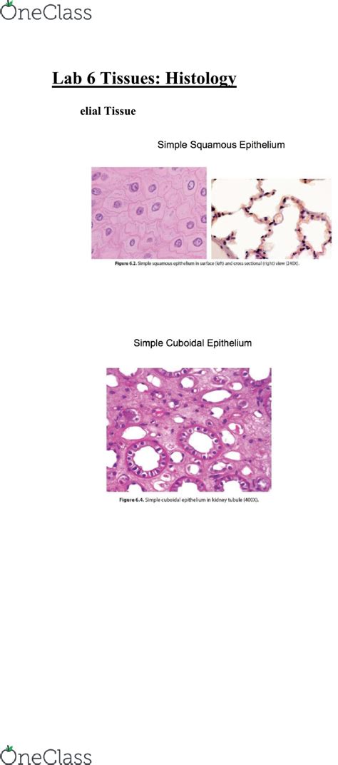 Stratified Squamous Epithelium Keratinized 400x