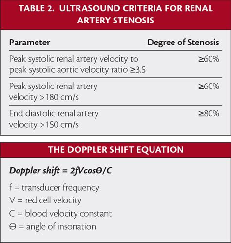 Diagnosis Of Iliac Vein Obstruction With Duplex Ultrasound, 48% OFF