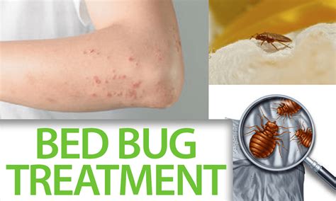 Most Effective Bed Bug Treatment Options | #1 Canadian Restaurant ...