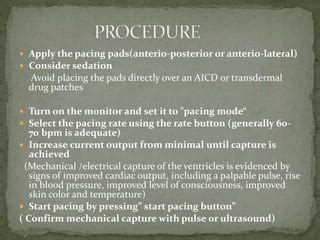 Transcutaneous pacing | PPT