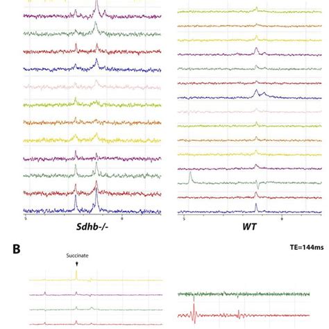 Figure S2 Succes In Sdhb Allografted Tumors In Mice A 1 H Mrs Download Scientific Diagram