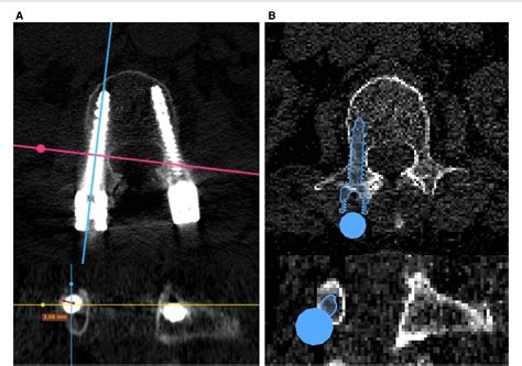 Figure 2 From Performance Evaluation Of An Ai Based Preoperative