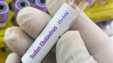 Iavi Doses First Patients With Sudan Ebolavirus Vaccine Candidate