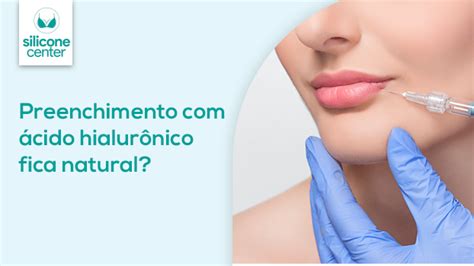 Preenchimento Com ácido Hialurônico Blog Silicone Center