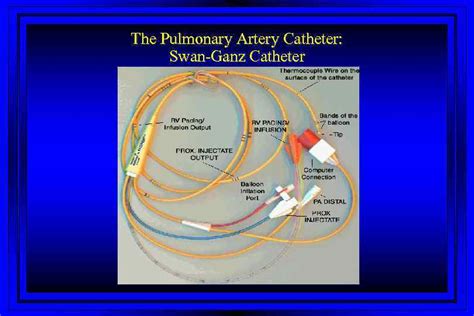 Right Heart Catheterization Swan Ganz Catheter Swan Ganz Catheter