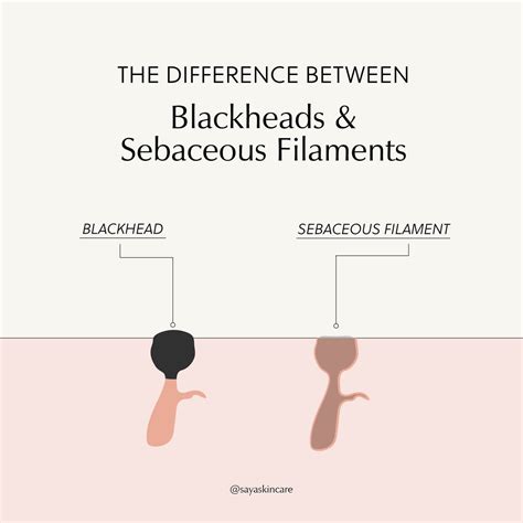 Sebaceous Filaments vs Blackheads | Saya® Skincare | Read Blog Now! | Saya®