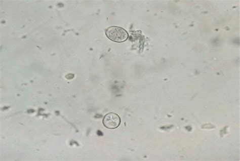 Giardia Cysts In Humans