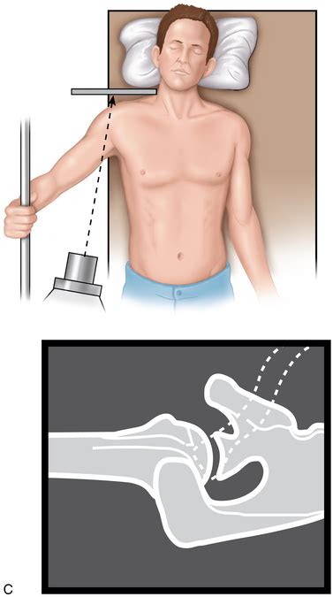 Radiographic Studies And Findings Musculoskeletal Key