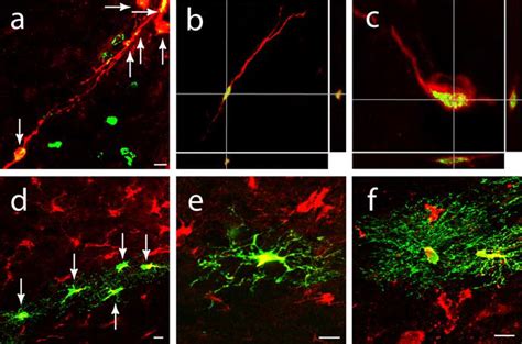 Newly Born Neuroblasts Migrate From The Svz To Peri Infarct Cortex