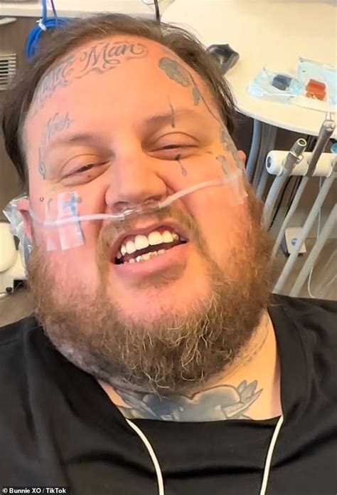 Jelly Roll Says He Feels Sexy As He Gets Veneers Replaced After 20 Years In Trends Now