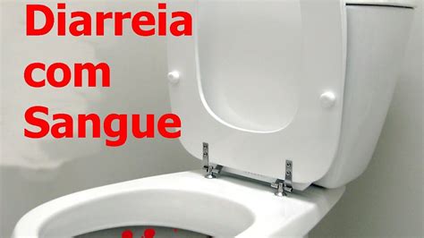 Diarreia Com Sangue Termo Tecnico - Diarreia Com Sangue Termo Tecnico - BRAINCP