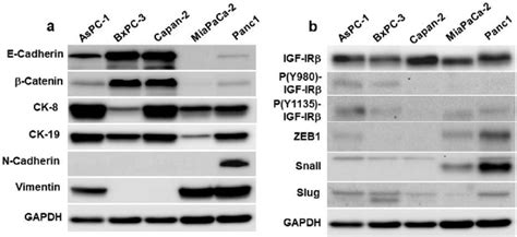 Western Blot Analysis