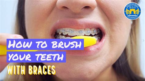 How To Brush With Braces Brushing Tips Youtube