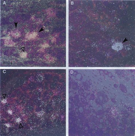 Emulsion Autoradiography Of Lumbar Rat DRG Neurons Labeled By