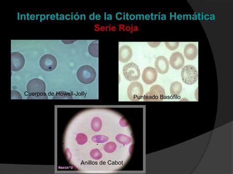 Interpretación de la citometría hemática pptx