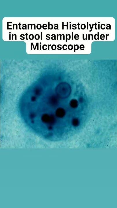 Entamoeba Histolytica In Stool Sample Under Microscope Youtube