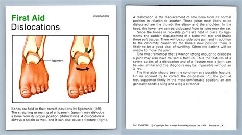 Dislocations First Aid Home Medical Guide 1975 8 Hamlyn Card