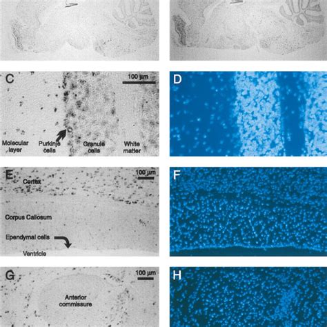 In Situ Hybridization Of Mbnac1 A E And G And Mbnac2 B And C