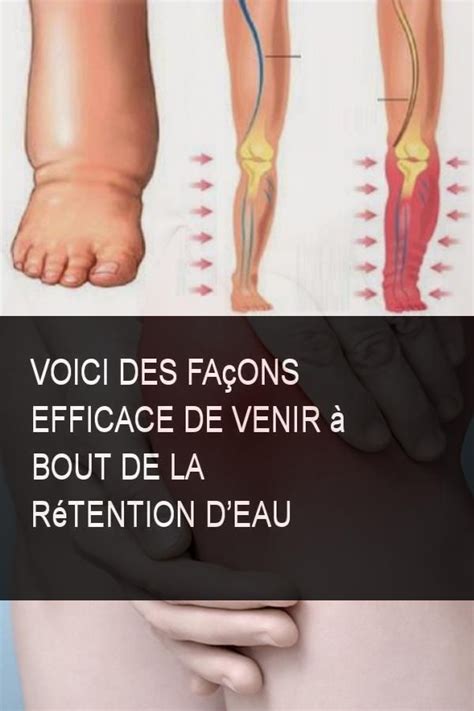 Voici des façons efficace de venir à bout de la rétention deau