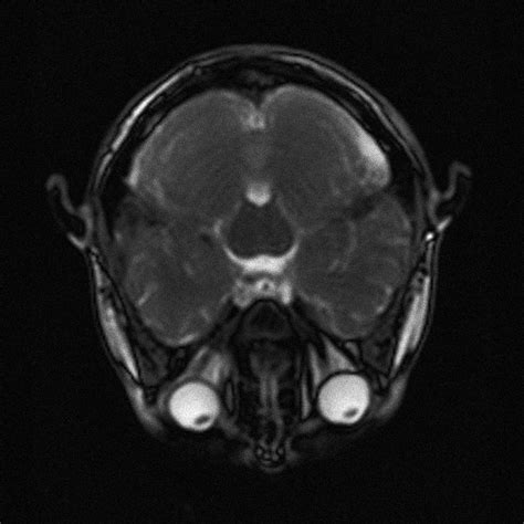 Irm Montrant Des Yeux Globuleux Photos Futura