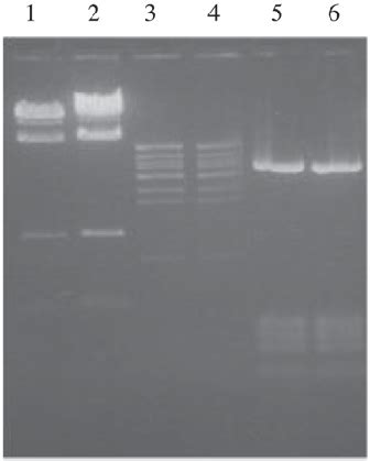 Comparative Cleavage Patterns Of Eco1524I And StuI Restriction Enzymes