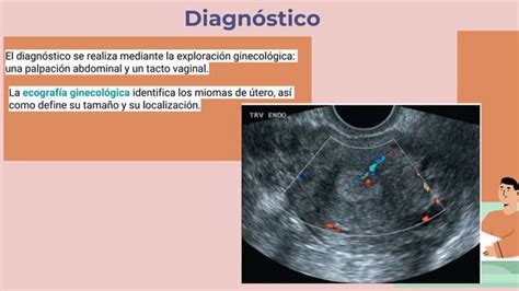 Miomas Uterinos Ginecologia Y Obstetricia Pptx