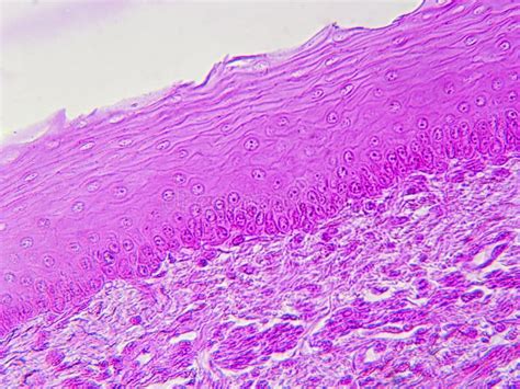 Esophageal Tissue Under The Microscope Stratified Squamous Epithelium