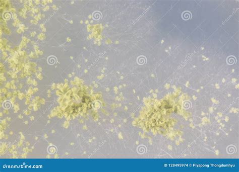 Aspergillus Oryzae Is A Filamentous Fungus, Under The Microscope In ...