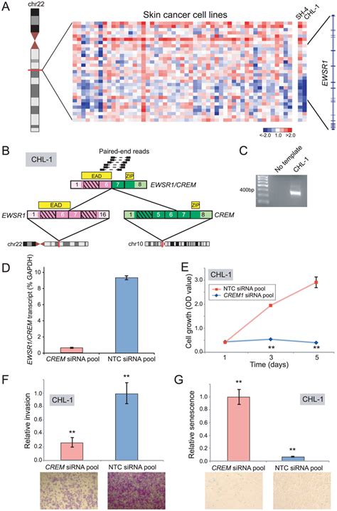 Discovery And Characterization Of EWSR1 CREM In Melanoma A Array CGH