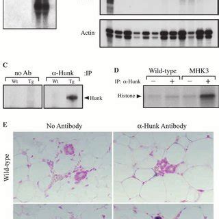 Heterogeneous Expression Of Hunk In The Mammary Epithelium A F In