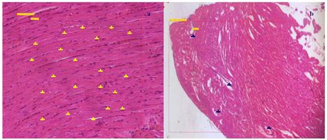 H E Staining Of Heart Section For Quantification Of Heart Muscle Cells