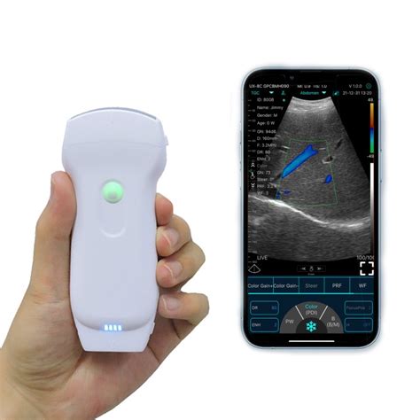 A comparison of handheld(wireless) ultrasound vs traditional ...