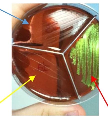 Eosin Methylene Agar Flashcards | Quizlet