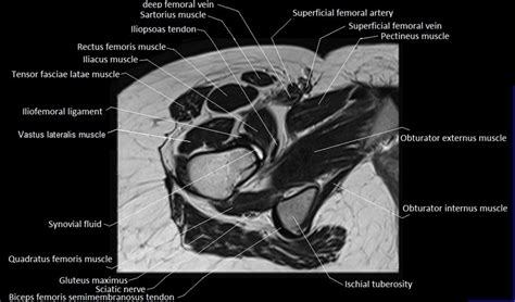 MRI Anatomy Of Hip Joint Free MRI Axial Hip Anatomy, 46% OFF