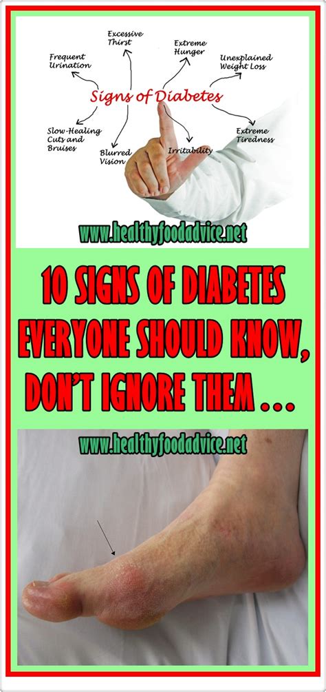 10 Signs Of Diabetes Everyone Should Know Don’t Ignore Them Healthy Food Advice