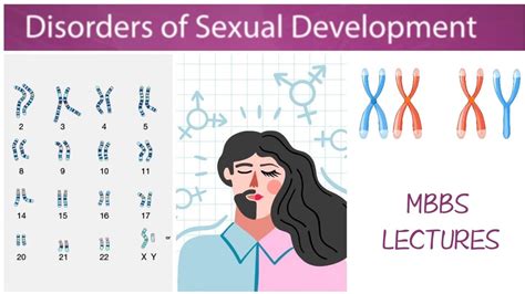 Gynae Chap3 Disorders Of Sexual Development 22 46 Xy Gonadal