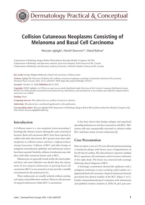 Pdf Collision Cutaneous Neoplasms Consisting Of Melanoma And Basal