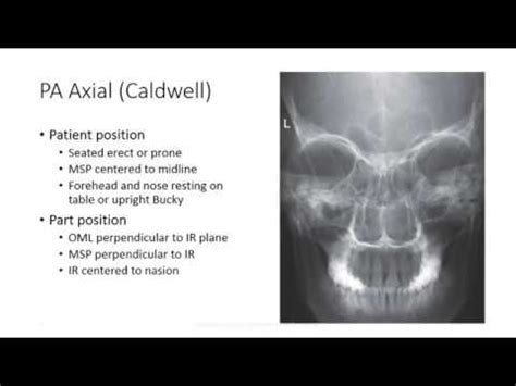 facial  ray positioning  ultimate  step mastery guide