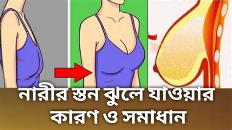 মেয়েদের স্তনbreast কেন ঝুলে যায় নারীর স্তন ঝুলে যাওয়ার কারণ ও