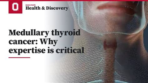 Medullary Thyroid Cancer Why Expertise Is Critical Ohio State Medical Center Youtube