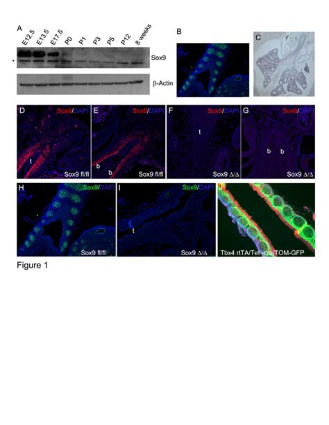 Expression Of Sox During Lung Development A Western Blot Analysis