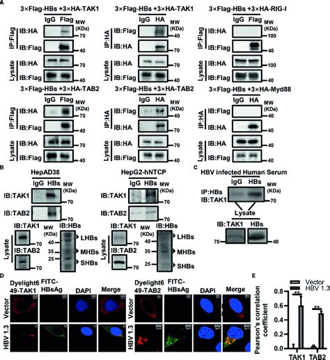 HBsAg Interacts With TAK1 And TAB2 Specifically In Vitro And In Vivo